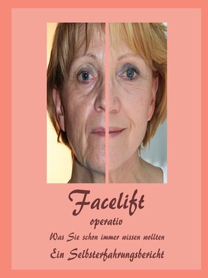 cover image of Facelift operativ